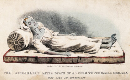 illustration of a person with cholera