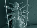 head louse holding hair strands