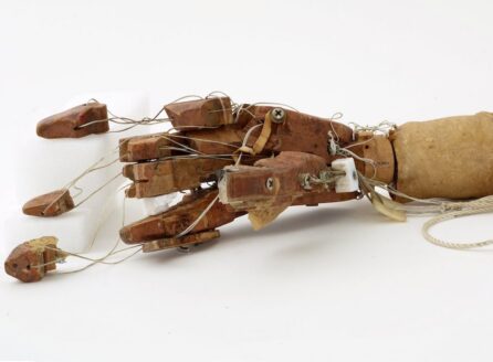 prosthetic arm with strings