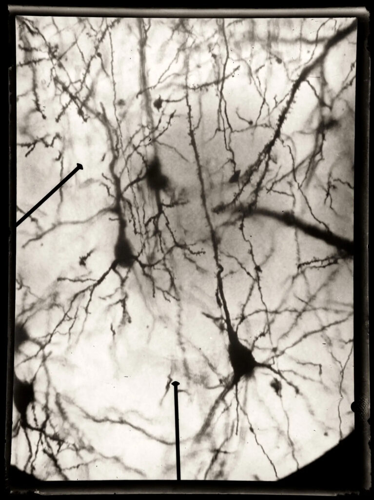 Black and white microphotograph of a nerve cell