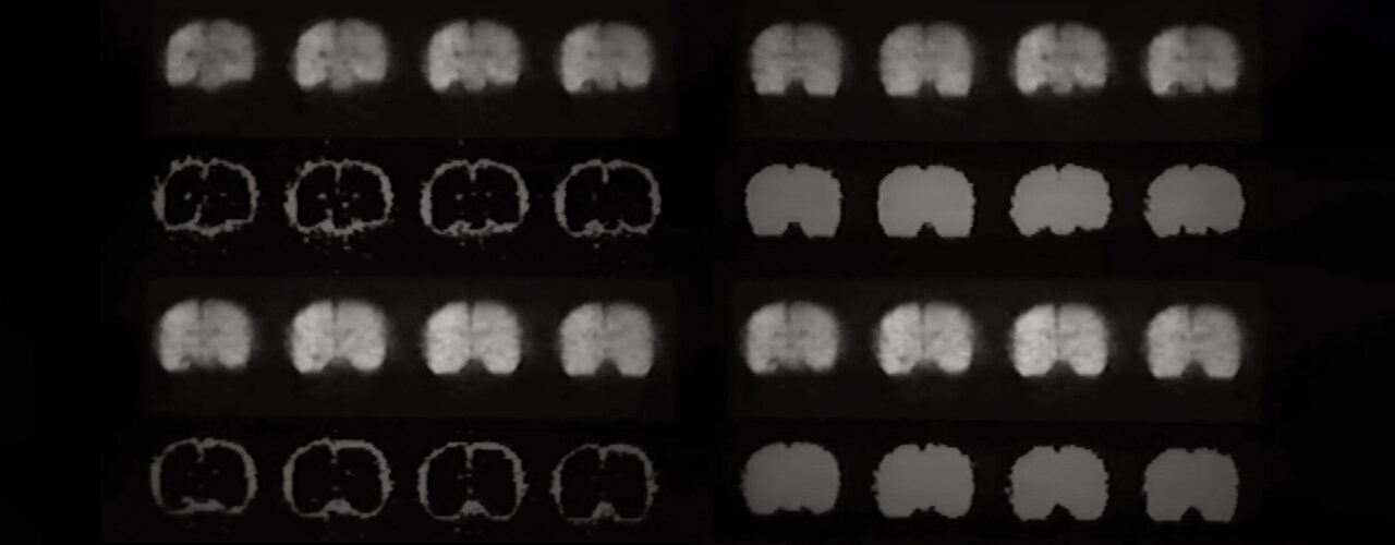 images of the brain from an MRI