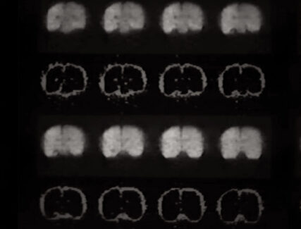 images of the brain from an MRI