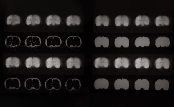 images of the brain from an MRI